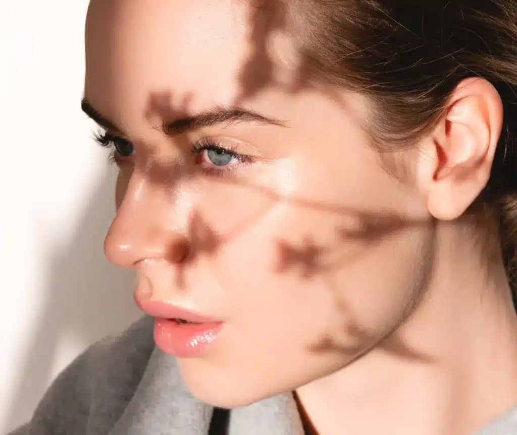 Acne en onzuiverheden biologisch aanpakken