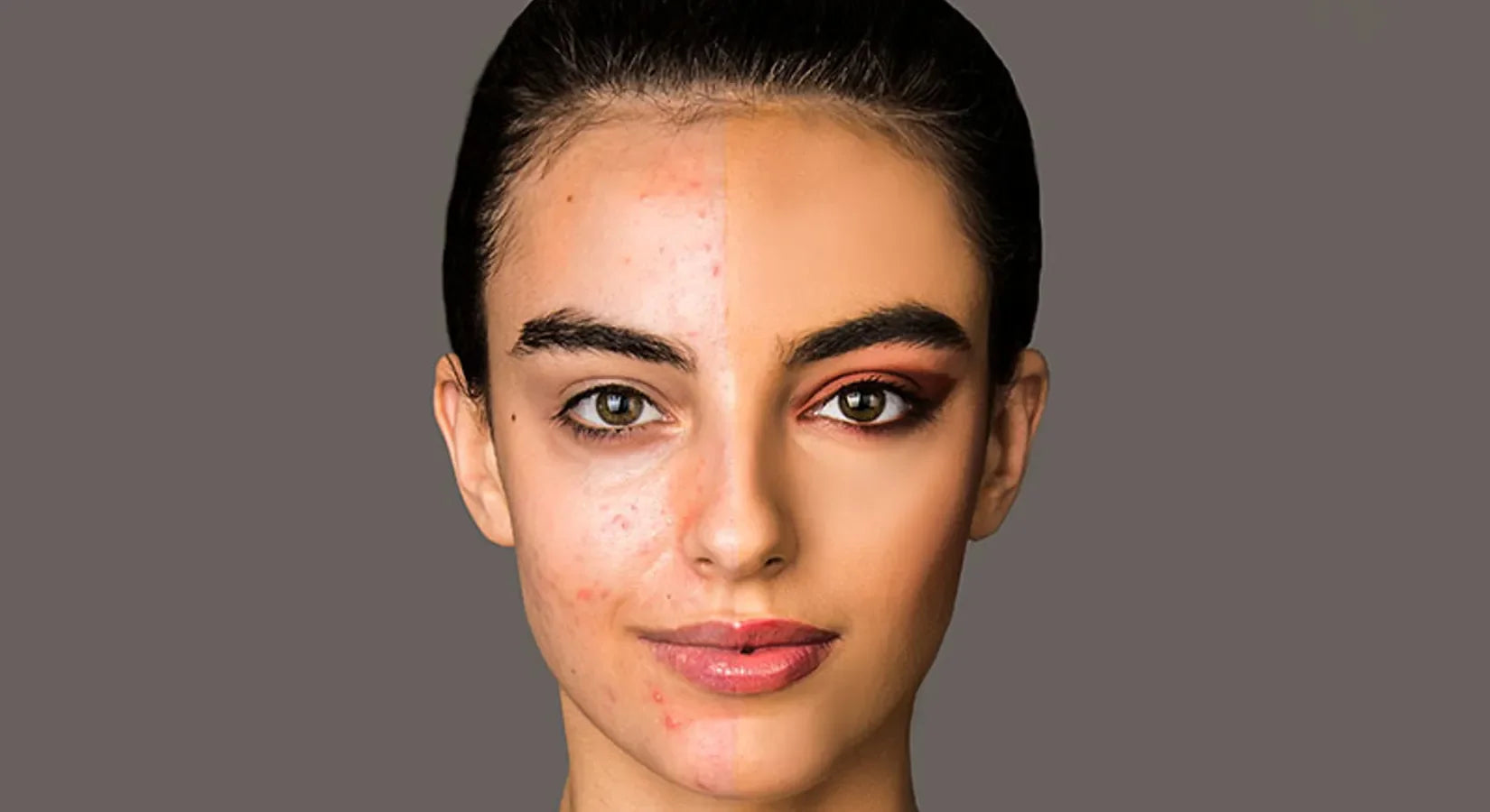Minerale make-up voor acne prone skin